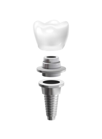 Dental Implants