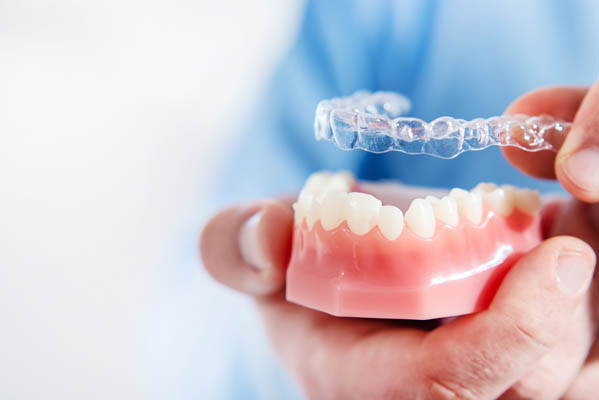 How Does Invisalign Work?