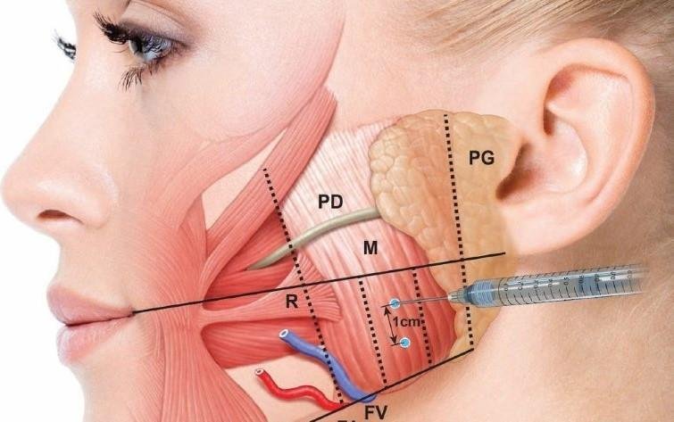 Who is a Candidate for Botox Treatment?