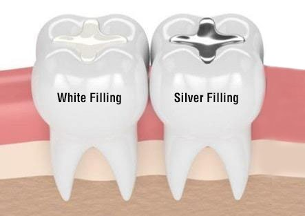 Advantages of Holistic Dentistry